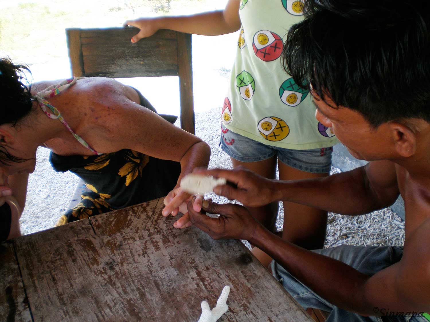 Picadura de erizo en Gili Meno - Indonesia